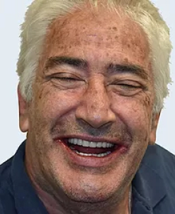 dale-after