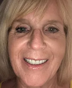 linda-after