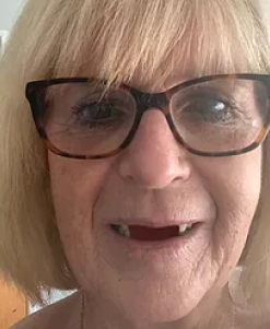 linda-before